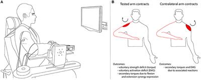 Abnormal synergies and associated reactions post-hemiparetic stroke reflect muscle activation patterns of brainstem motor pathways